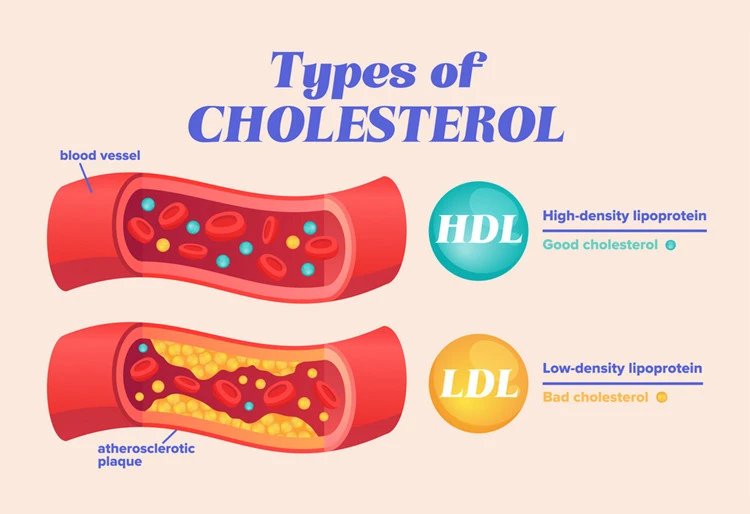 product-750-514 Types of Cholesterol
